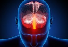 US approves new drug for prevention of migraines
