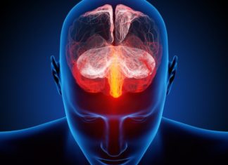 US approves new drug for prevention of migraines