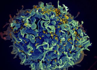 Unlocking the secrets of HIV’s persistence