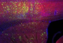 Where Brain Cells Get Their Information May Determine Their Roles in Diseases