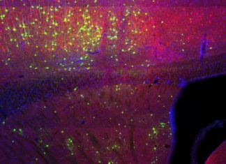 Where Brain Cells Get Their Information May Determine Their Roles in Diseases
