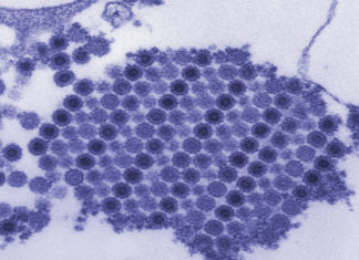 Why chikungunya, other arthritis-causing viruses target joints