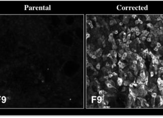 Single injection treats hemophilia B for life, in proof-of-concept study