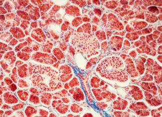 A gene previously linked with obesity has been found to affect how the body processes insulin, with potential implications for some forms of diabetes