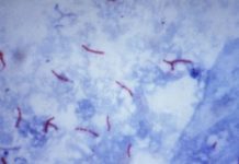 A gene signature in the bloodstream could reveal whether someone is going to develop active tuberculosis