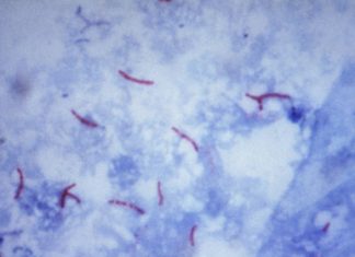A gene signature in the bloodstream could reveal whether someone is going to develop active tuberculosis