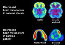 A new study reveals how cocaine use alters gene expression and provides new insight into the molecular basis of cocaine addiction