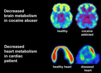 A new study reveals how cocaine use alters gene expression and provides new insight into the molecular basis of cocaine addiction
