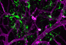 A research team at Massachusetts Eye and Ear has shown that microglia, the primary immune cells of the brain and retina, play a protective role in response to retinal detachment