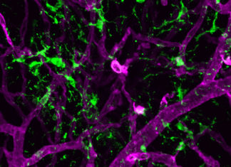 A research team at Massachusetts Eye and Ear has shown that microglia, the primary immune cells of the brain and retina, play a protective role in response to retinal detachment