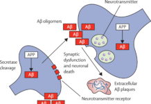 Report : Alcohol may impede the clearance of amyloid beta, a protein associated with Alzheimer’s disease, in the brain