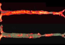 Antibody blocks inflammation, protects mice from hardened arteries and liver disease