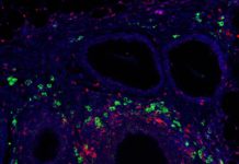 Biomaterial particles educate immune system to accept transplanted islets