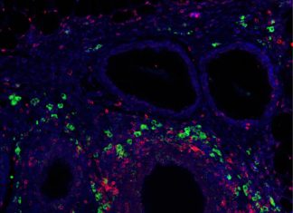 Biomaterial particles educate immune system to accept transplanted islets