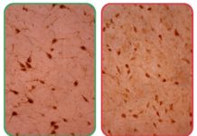 Change in brain cells linked to opiate addiction, narcolepsy