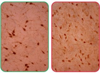 Change in brain cells linked to opiate addiction, narcolepsy