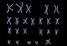 Discovered Genes linking Alzheimer’s and Down syndrome