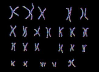 Discovered Genes linking Alzheimer’s and Down syndrome