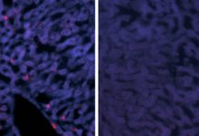 Genetically humanized mice could boost fight against aggressive hepatitis