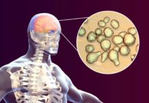 How a Killer Fungus Unleashes Meningitis and Brain Infections