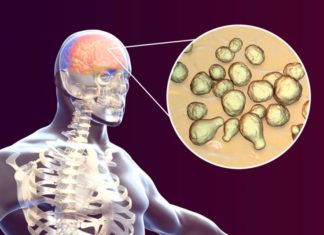 How a Killer Fungus Unleashes Meningitis and Brain Infections