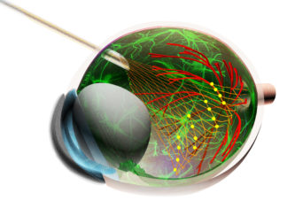 Injectable electronics offer powerful new tool in understanding how retinal cells work