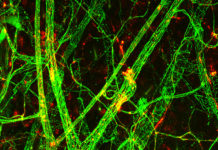 Leakage from the blood capillaries is a key mechanism leading to septic shock and multiorgan failure, which affect millions of patients annually worldwide. However, there is no effective way to inhibit the vessel leakiness