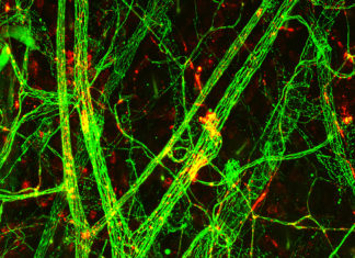 Leakage from the blood capillaries is a key mechanism leading to septic shock and multiorgan failure, which affect millions of patients annually worldwide. However, there is no effective way to inhibit the vessel leakiness