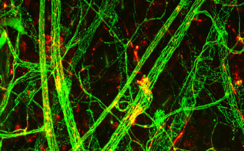 Leakage from the blood capillaries is a key mechanism leading to septic shock and multiorgan failure, which affect millions of patients annually worldwide. However, there is no effective way to inhibit the vessel leakiness