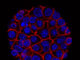 Lipid molecules can be used for cancer growth