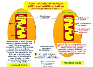 Mutations in the gene ANT1 may confer a risk for bipolar disorder through a complex interplay between serotonin and mitochondrial signaling in the brain