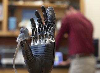 New Technology : e-dermis brings sense of touch, pain to prosthetic hands
