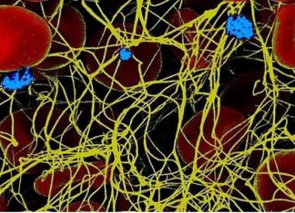 New research has identified the way nature creates its own plaster to try and prevent bacteria and other micro-organisms from penetrating open wounds