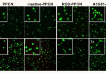 Regenerative bandage accelerates healing in diabetic wounds