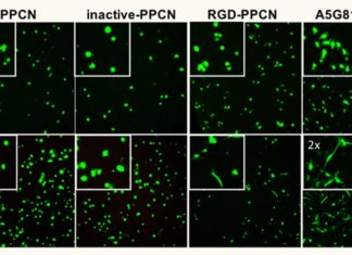 Regenerative bandage accelerates healing in diabetic wounds