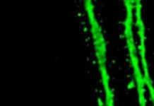 Repeated stimulation enlarges dendritic spines