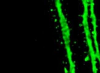 Repeated stimulation enlarges dendritic spines