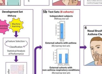 Research team diagnoses asthma with nasal brush test