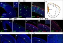 Researchers Solve the Case of the Missing Subplate Cell
