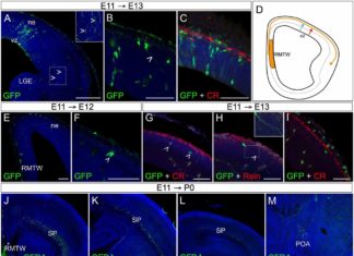 Researchers Solve the Case of the Missing Subplate Cell