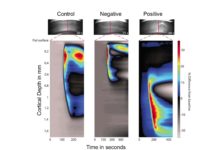 Researchers has identified the electrical activity specific to the start of migraines and demonstrated a way to stop it in animal experiments