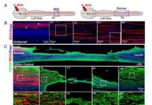 Researchers repair acute spinal cord injury in monkeys