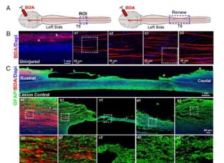 Researchers repair acute spinal cord injury in monkeys