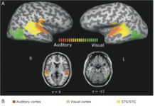 Researchers reports speech comprehension can improve as much as 10% when sound is delayed relative to vision
