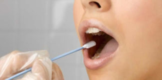 Risk of burnout can be estimated by analysing saliva samples