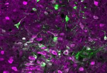 Serotonin speeds learning