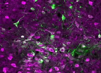 Serotonin speeds learning