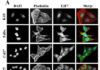 University of Queensland researchers have discovered how to reverse drug resistance in skin and mouth squamous cell carcinomas