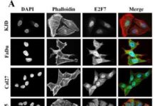 University of Queensland researchers have discovered how to reverse drug resistance in skin and mouth squamous cell carcinomas