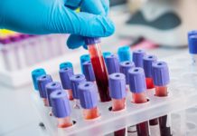 World-first test could predict risk of heart attack in coronary artery disease patients
